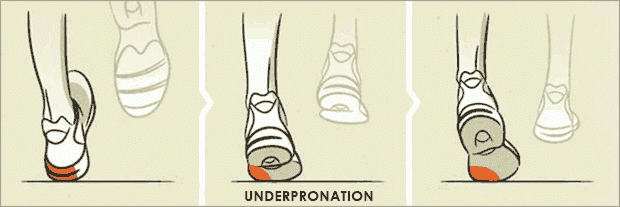 under-pronation